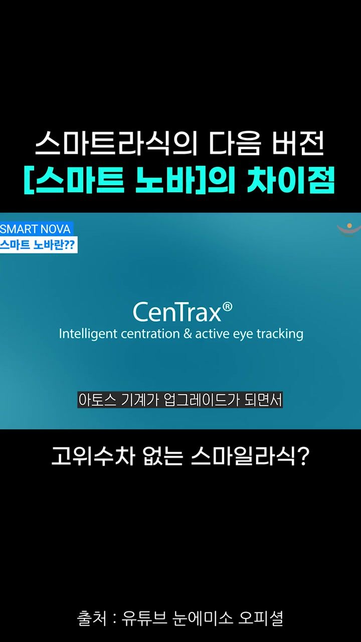 2026년 기준 최신 스마일라식 [스마트 노바]의 차이점